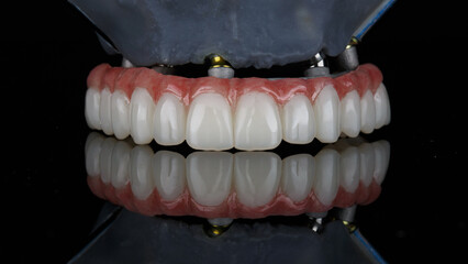 excellent dental prosthesis of the upper jaw on the beam and skull model on black glass with reflection © Dental Pro Content
