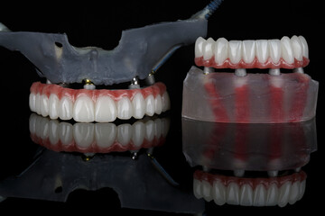 dental composition of models and two prostheses of the upper and lower jaws on black glass with reflection