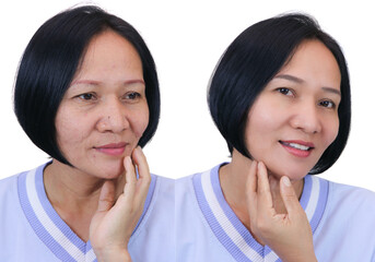 woman before and after retouch,