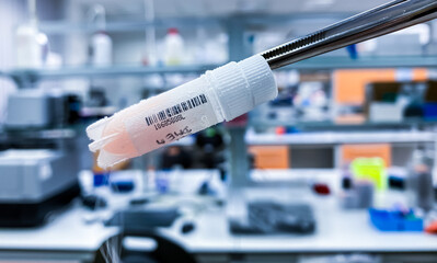 A cryovial containing frozen human cancer cells preserved in liquid nitrogen for research purposes....