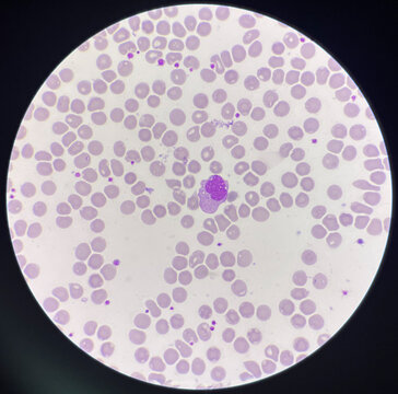 Monocyte white blood cells on center.