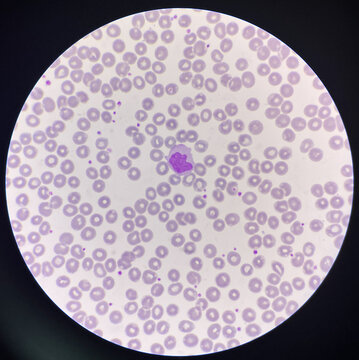 Monocyte white blood cells on center.