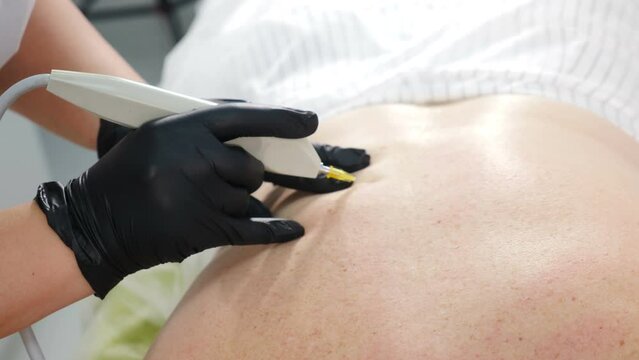 Aesthetic beauty clinic. Mesotherapy, ozone therapy. Carbon dioxide carboxy therapy. CO2 injections. Skin rejuvenation. Cosmetologist doctor using needle on device for gas injections of carboxytherapy