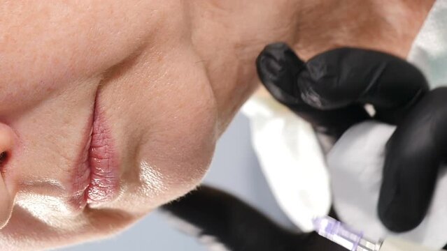 Carboxytherapy injections. Gas invasive therapy. Vertical footage. Cosmetologist using carbon dioxide CO2 injection machine on back. Senior woman getting body care fat treatment. Skin rejuvenation. 4