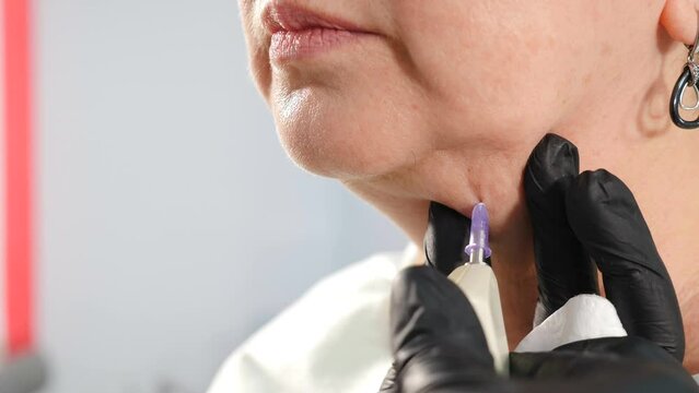 Aesthetic beauty clinic. Mesotherapy, ozone therapy. Carbon dioxide carboxy therapy. CO2 injections. Skin rejuvenation. Cosmetologist doctor using needle on device for gas injections of carboxytherapy