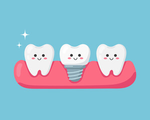Cute teeth and tooth implant. Vector illustration
