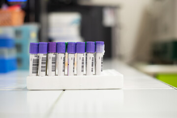 Test tube CBC in laboratory.