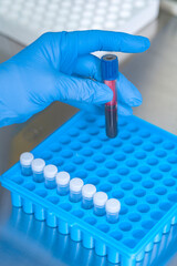 hands of a lab technician with a tube of blood sample and a rack with other samples / lab technician holding blood tube sample for study.Corona virus pandemic concept.