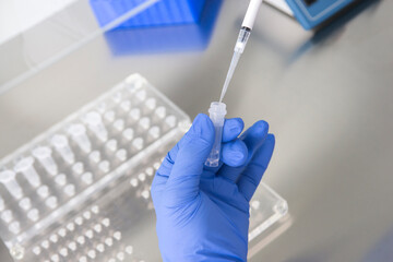 Doctor holding blood tube test in the research laboratory.Corona virus pandemic concept.Coronavirus vaccine development