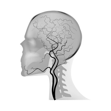 MR angiography of cerebral vessels. Magnetic resonance imaging. Vector illustration