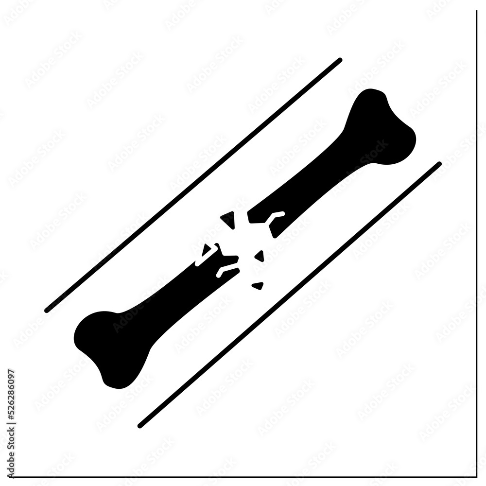 Poster comminuted fracture glyph icon. break or splinter of bone into more than two fragments.crashes. heal
