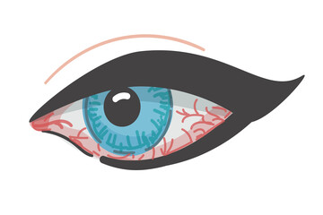 Redness of the eye. Eyeball disease. Vector illustration. Isolated icon. Cartoon style. Conjunctivitis, inflammation. 