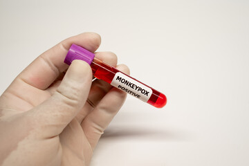 Obraz premium Close-up of Blood sample tube positive with Monkeypox virus,monkeypox positive