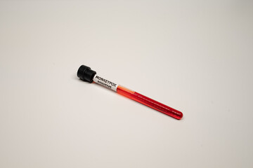 Close-up of Blood sample tube positive with Monkeypox virus,monkeypox positive