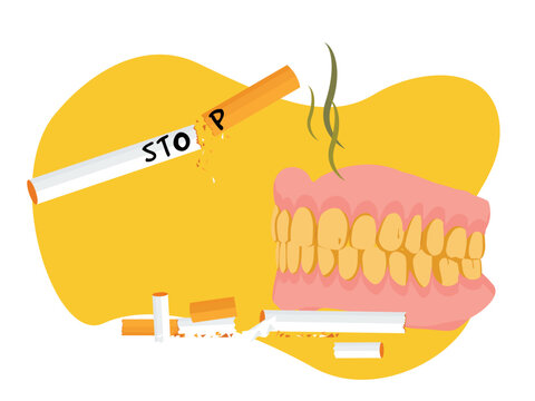 Teeth that are yellow and rotting from cigarettes. Stop smoking.