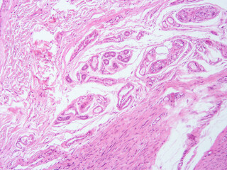 Histology of human tissue, show  epithelial tissue and connective tissue with microscope view  from laboratory (not Illustration Designation)