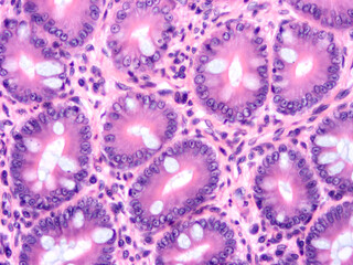 Histology of human tissue, show  epithelial tissue and connective tissue with microscope view  from laboratory (not Illustration Designation)
