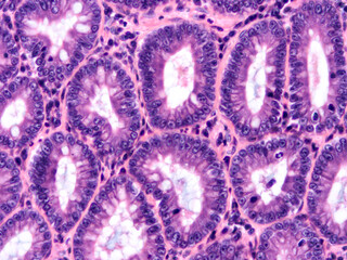 Histology of human tissue, show  epithelial tissue and connective tissue with microscope view  from laboratory (not Illustration Designation)