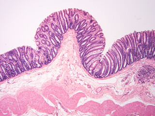Histology of human tissue, show  epithelial tissue and connective tissue with microscope view  from laboratory (not Illustration Designation)