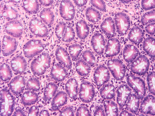 Histology of human tissue, show  epithelial tissue and connective tissue with microscope view  from laboratory (not Illustration Designation)