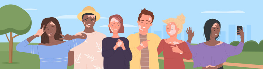 Diverse group of people with vitiligo standing together vector illustration. Cartoon young cute male and female characters hugging, using mobile phone for selfie background. Body positive concept