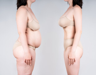 Woman's body before and after weight loss or liposuction on gray background