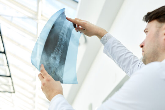 Low angle view of expert doctor holding x ray image and examining spine injury, copy space