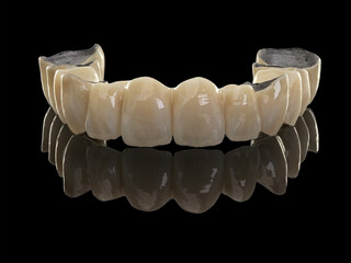 dental metal ceramic bridge on black reflective surface
