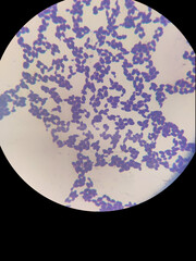 A fixed preparation of yeast stained with gentian violet that buds under a microscope with immersion