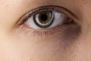 Peeling skin under the human eye hazel.