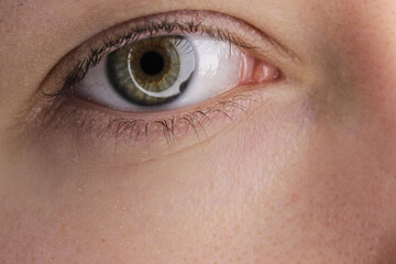 Eye without makeup for medical designations