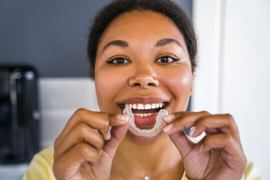 Multiracial woman with beautiful smile holding transparent mouth guard for teeth whitening