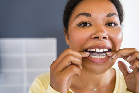 Smiling Multiracial Woman With Healthy Teeth Using Removable Clear Braces Aligner