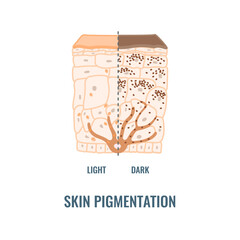 Melanin content and distribution in different skin phototypes. Pigmentation mechanism in dark and light skin. Epidermis cross-section infographic medical diagram. Vector illustration.