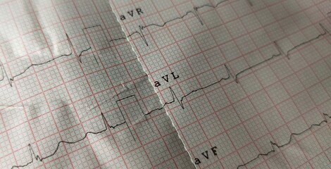 Test record of electrocardiogram (ECG or EKG) heart beat rate or rhythm frequency wave line graph...