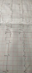 Test record of electrocardiogram (ECG or EKG) heart beat rate or rhythm frequency wave line graph report on paper. Life, health care, diagnosis, health, cardiology and medical concept. Close up view.