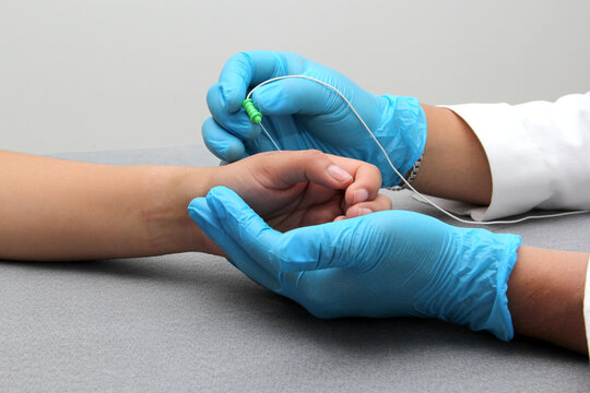 Electromyography is a graphic recording technique of the electrical activity of the muscles known as electromyogram or EMG, it is monitored through intramuscular electrodes
