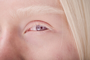 Close-up of young face of albino girl with blue eyes and white eyelashes - obrazy, fototapety, plakaty