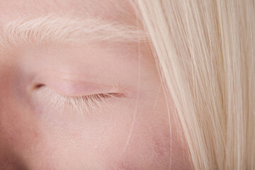 Close-up of albino girl having natural beauty with white eyebrows and eyelashes - obrazy, fototapety, plakaty