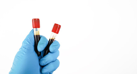 A blood test sample tube with a red cap is in the hand of a blue gloved doctor, object isolated on white background and horizontal copy space, hematology healthcare laboratory concept