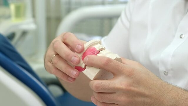 Dental technician holding plaster cast of jaws while making denture in lab