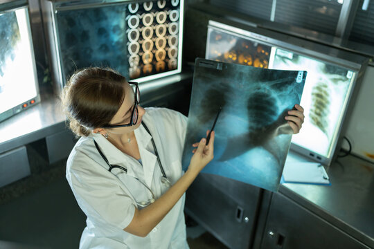 Woman radiology doctor examining chest x-ray film of patient in health care medical laboratory at hospital