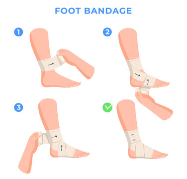 Limb bandaging step-by-step instructions. Help with leg injuries. Bandaging a human leg. Vector illustration