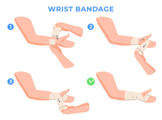 Limb bandaging step-by-step instructions. Help with hand injuries. Bandage of a person hand. Vector illustration