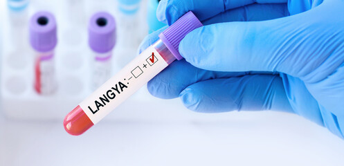 Doctor holding a test blood sample tube with positive Langya henipavirus (LayV) on the background...