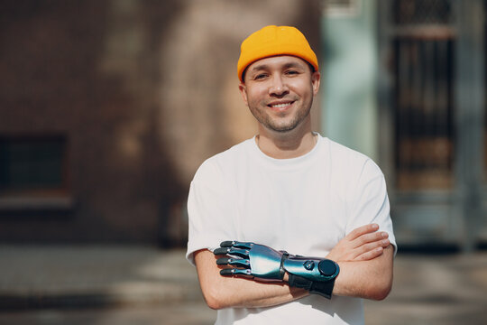 Young disabled man with artificial prosthetic crossed hand portrait in casual clothes