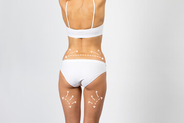 Cellulite removal scheme on body young girl. White arrows markings on the waist and legs woman.