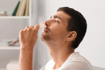Young man wiping nosebleed with tissue at home, closeup
