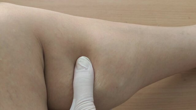 Portrait the fingers holding the calf and muscle, varicose veins and spider, problem circulation of blood and cramp, overweight and scar on the leg of the woman, health care and beauty concept.