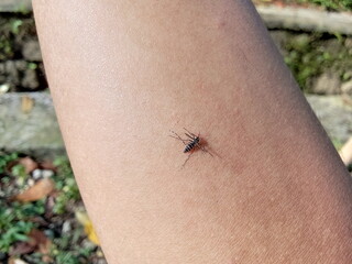 mosquito that sucks blood on hand